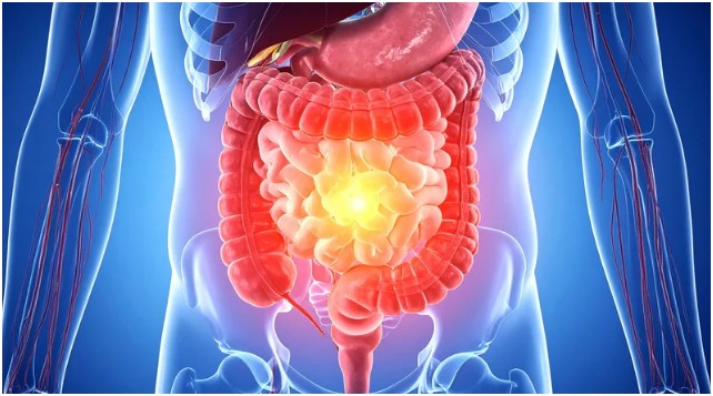 The Gut-Skin Connection