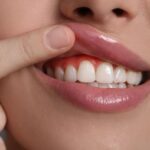 Gum Trouble Uncovered - Top Causes of Gum Disease