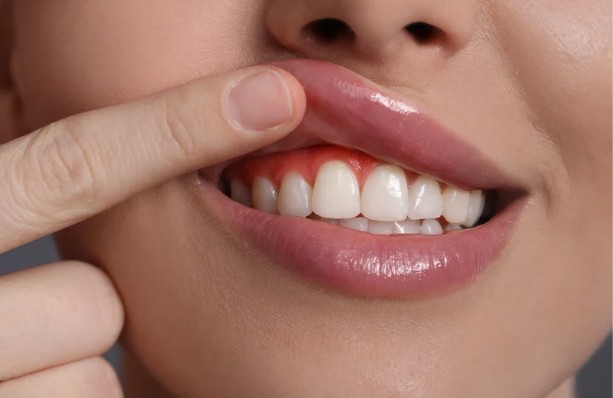 Gum Trouble Uncovered - Top Causes of Gum Disease